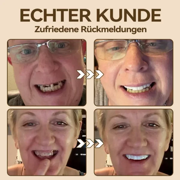 𝐇𝐢𝐝𝐨𝐧𝐞®🚀 - 🦷𝐏𝐫𝐞𝐦𝐢𝐮𝐦 𝐆𝐞𝐛𝐢𝐬𝐬🦷（✨Geeignet für alle Mundformen, speziell angefertigte Zahnersätze für die perfekte Passform✨）