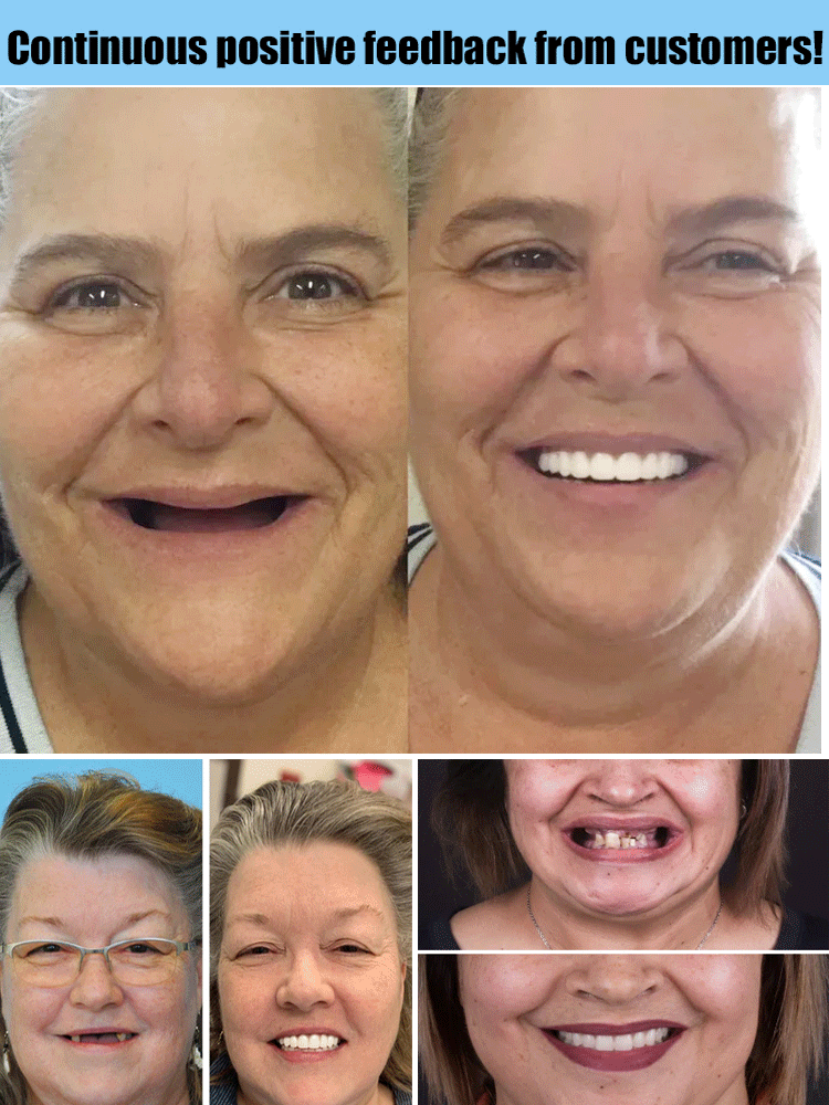 𝐇𝐢𝐝𝐨𝐧𝐞® 🦷Advanced Customized Full Denture Set🦷 (🔥10,000+ Sold In Last 30 Day)