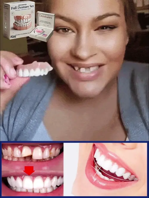 𝐇𝐢𝐝𝐨𝐧𝐞® 🦷Advanced Customized Full Denture Set🦷 (🔥10,000+ Sold In Last 30 Day)
