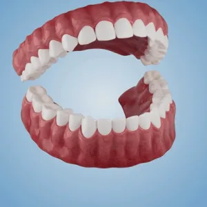 𝐇𝐢𝐝𝐨𝐧𝐞® 🐱‍🐉💦- 𝐏𝐫𝐞𝐦𝐢𝐮𝐦 𝐃𝐞𝐧𝐭𝐮𝐫𝐞- (✨Suitable for all mouth shapes, custom-made dentures for a perfect fit✨）