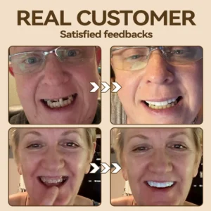 𝐇𝐢𝐝𝐨𝐧𝐞® 🐱‍🐉💦- 𝐏𝐫𝐞𝐦𝐢𝐮𝐦 𝐃𝐞𝐧𝐭𝐮𝐫𝐞- (✨Suitable for all mouth shapes, custom-made dentures for a perfect fit✨）