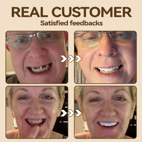 𝐇𝐢𝐝𝐨𝐧𝐞® 🐱‍🐉💦- 𝐏𝐫𝐞𝐦𝐢𝐮𝐦 𝐃𝐞𝐧𝐭𝐮𝐫𝐞- (✨Suitable for all mouth shapes, custom-made dentures for a perfect fit✨）