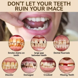 𝐇𝐢𝐝𝐨𝐧𝐞® 🐱‍🐉💦- 𝐏𝐫𝐞𝐦𝐢𝐮𝐦 𝐃𝐞𝐧𝐭𝐮𝐫𝐞- (✨Suitable for all mouth shapes, custom-made dentures for a perfect fit✨）