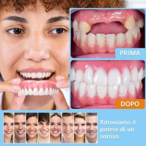 HEATWOLF® Set di protesi dentarie complete personalizzate avanzate🦷 (Sconto a tempo limitato negli ultimi 30 minuti)🎁