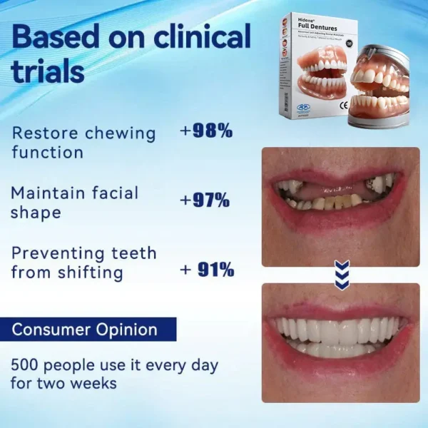 Hidone®Full Denture Set🦷Advanced Self-Adjusting Dental Materials💃💃 (⏰Limited time discount last 30 minutes⏰)