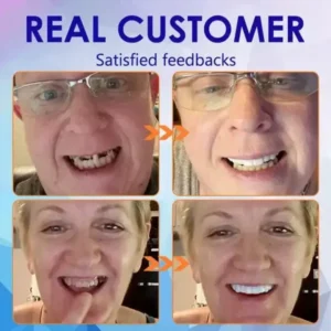 Vaxflite™ Ease Dentures