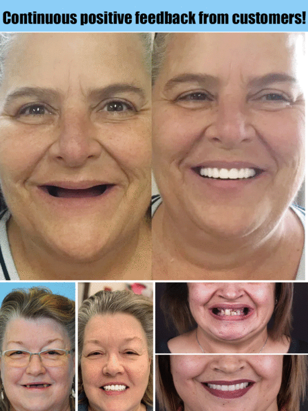 𝐇𝐢𝐝𝐨𝐧𝐞® 🦷Advanced Customized Full Denture Set🦷 (🔥10,000+ Sold In Last 30 Day)