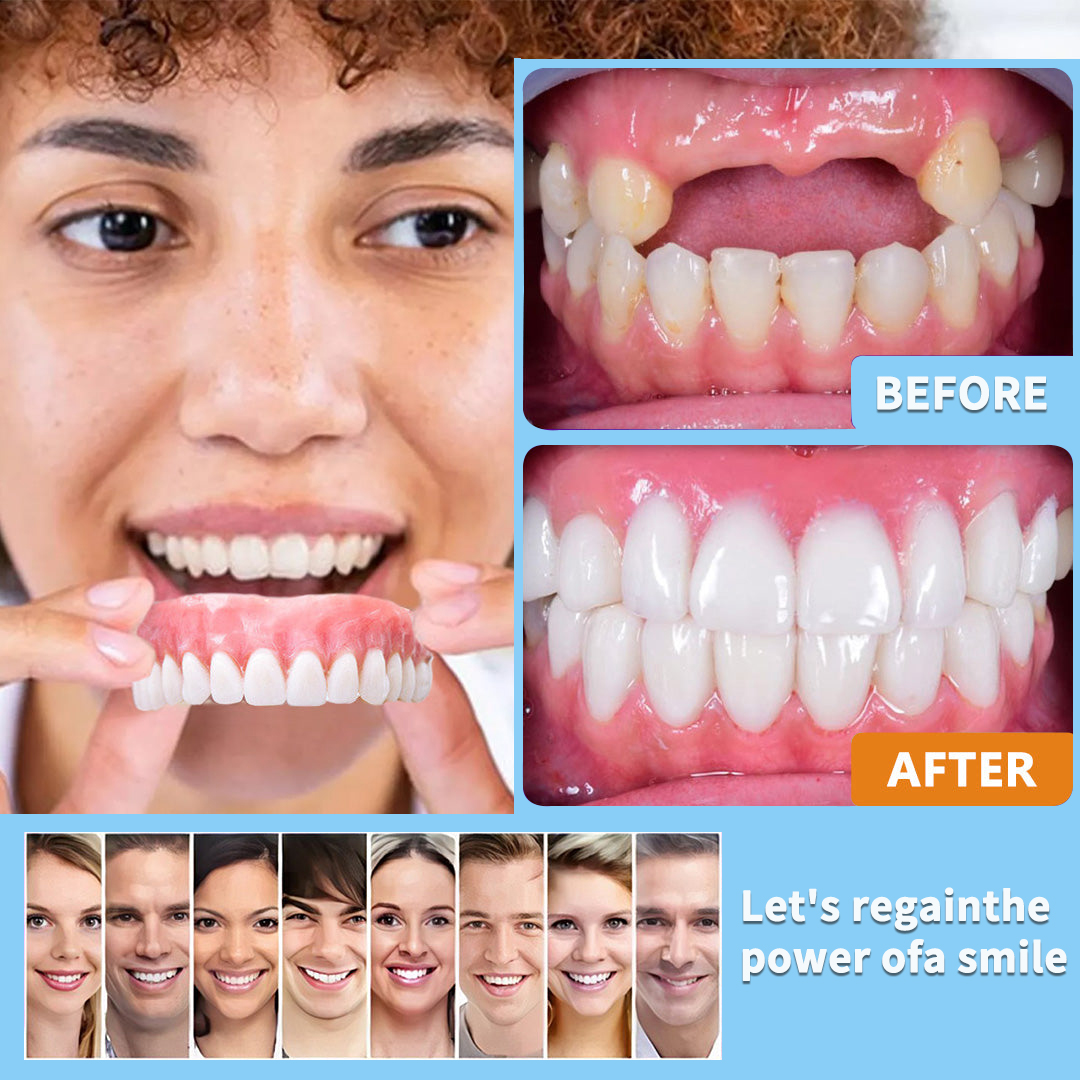 𝐇𝐢𝐝𝐨𝐧𝐞®💛 --🦷Custom Full Denture Set🦷 (⏰Limited Time Discount, Last 30 Minutes⏰)