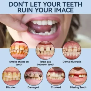 Bikenda® 👧🏻🔆- 𝐏𝐫𝐞𝐦𝐢𝐮𝐦 𝐃𝐞𝐧𝐭𝐮𝐫𝐞- (✨Suitable for all mouth shapes, custom-made dentures for a perfect fit✨）