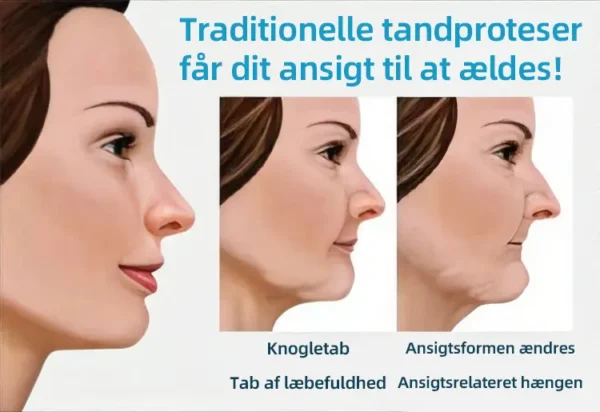 Hidone® Fuldt tandproteser Sæt 🦷🦷💃Avancerede selvjusterende tandlæge Materialer (⏰Begrænset tidsrabat sidste 30 minutter⏰)