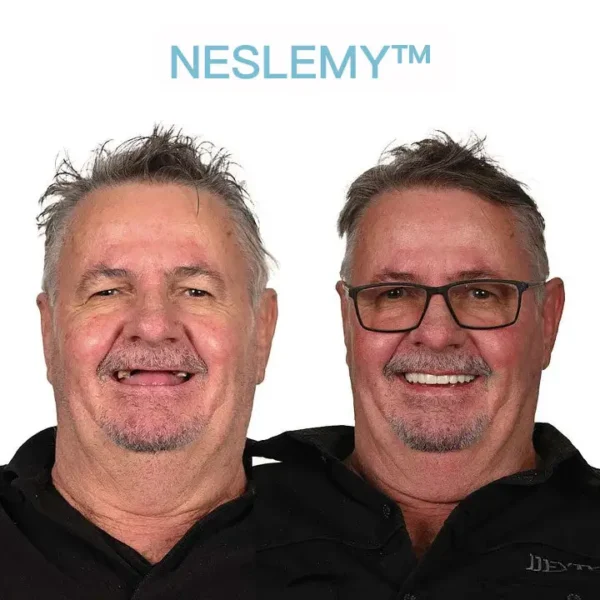 NESLEMY™ GelFit Dentures – Made in the USA & FDA-Certified