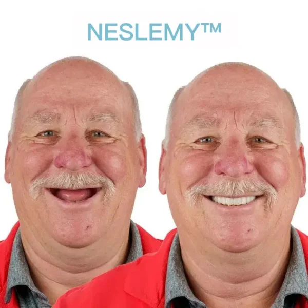 NESLEMY™ GelFit Dentures – Made in the USA & FDA-Certified