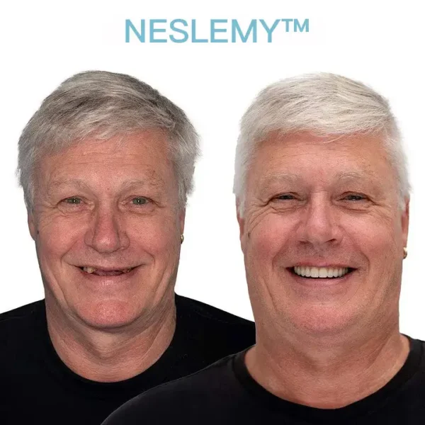 NESLEMY™ GelFit Dentures – Made in the USA & FDA-Certified