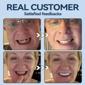 SmileFitPro® – 𝐌𝐞𝐝𝐢𝐜𝐚𝐥𝐅𝐢𝐭 𝐀𝐝𝐚𝐩𝐭𝐢𝐯𝐞 𝐃𝐞𝐧𝐭𝐮𝐫𝐞𝐬🦷Suitable for all mouth shapes, perfect fit🦷(⏰Limited time 50% off, last 30 minutes⏰)