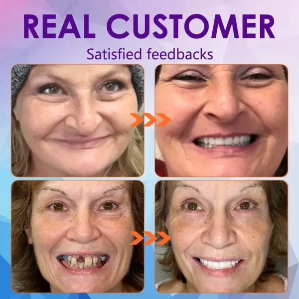 😁 "Snap In. Stay Put. Smile All Day — Or Your Money Back!" 𝗠𝗲𝗱𝗶𝗰𝗮𝗹-𝗚𝗿𝗮𝗱𝗲 𝗙𝘂𝗻𝗰𝘁𝗶𝗼𝗻𝗮𝗹 𝗧𝗵𝗶𝗰𝗸𝗲𝗻𝗲𝗱 𝗗𝗲𝗻𝘁𝘂𝗿𝗲𝘀