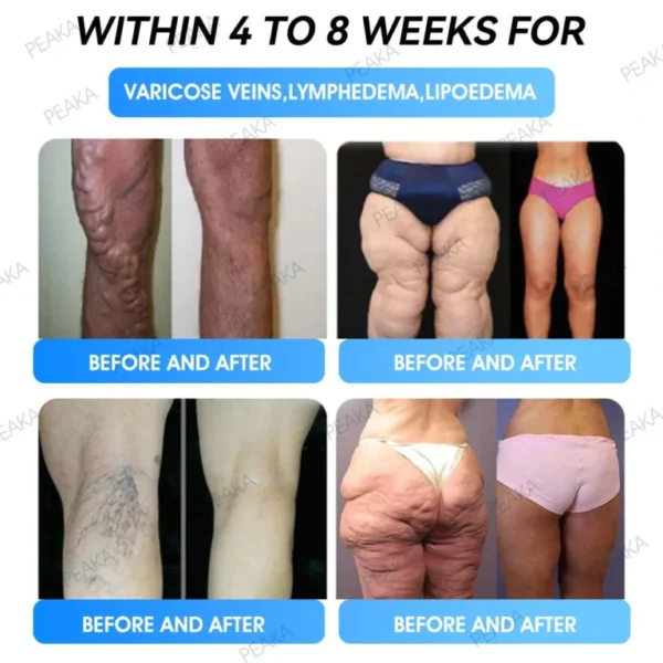【Last Day Promotion 80% OFF🥇】PEAKA® GLP‑1 Seven-in-One Slimming Vitality Boost Oral Strips 👩‍⚕️ TGA-Certified | 1 Strip Daily | Visible Results in 7 Days ✅ Supports Weight Loss, Heart Health, Blood Sugar, Sleep & Joint Mobility