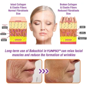 YUNPSO™ Queen Nectar Peptide + Bakuchiol Skin Restoration Cream - Anti-aging, Hydrating, Skin Firming & Lifting, Skin Repair, Even Tone, Acne and Dark Spot Treatment, Wart and Mole Removal, and Psoriasis Relief.