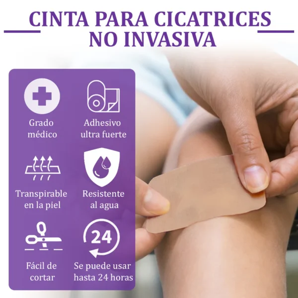 🏷️ Tienda Oficial: Flysmus® ReGen Cinta de Micronadles con Ácido Hialurónico Nano-Heal 💝 Tratamiento de cicatrices nuevas y antiguas, reducción de cicatrices quirúrgicas, estrías, queloides, acné, quemaduras, verrugas, dermatomas y venas varicosas