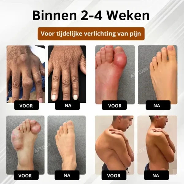 MagniBee™ Gewrichtsondersteuning Formule Spuitbus | Verlicht stijve gewrichten en herstel je soepele beweging in 7 dagen