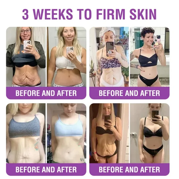 YUNPSO™ Queen Nectar Peptide + Bakuchiol Skin Restoration Cream - Anti-aging, Hydrating, Skin Firming & Lifting, Skin Repair, Even Tone, Acne and Dark Spot Treatment, Wart and Mole Removal, and Psoriasis Relief.