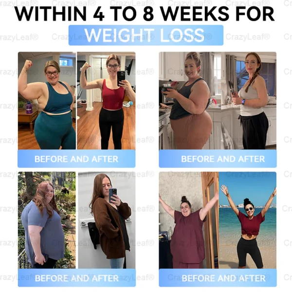 🇨🇦Clinically Proven| Official Store | BuildLeaf® Tirzepatide Slimming & Health Nano Microneedle Patch |Targets Obesity, Loose Skin, High Blood Pressure, Diabetes, Fatty Liver, Joint Pain, Brain Fog, Low Energy, Body Aches, and More