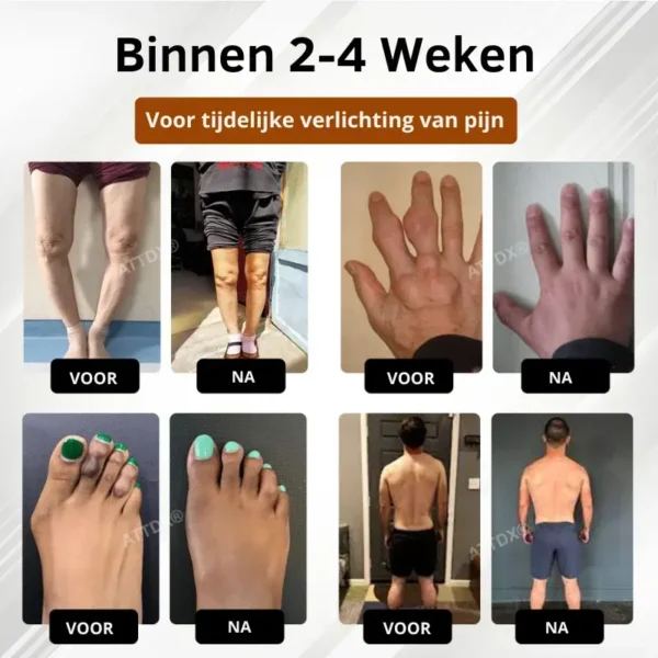 MagniBee™ Gewrichtsondersteuning Formule Spuitbus | Verlicht stijve gewrichten en herstel je soepele beweging in 7 dagen