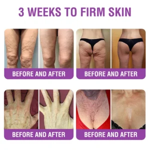 YUNPSO™ Queen Nectar Peptide + Bakuchiol Skin Restoration Cream - Anti-aging, Hydrating, Skin Firming & Lifting, Skin Repair, Even Tone, Acne and Dark Spot Treatment, Wart and Mole Removal, and Psoriasis Relief.