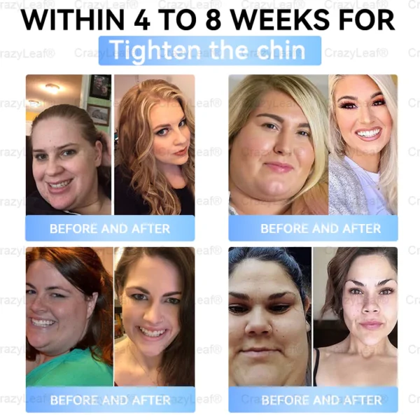 🇨🇦Clinically Proven| Official Store | BuildLeaf® Tirzepatide Slimming & Health Nano Microneedle Patch |Targets Obesity, Loose Skin, High Blood Pressure, Diabetes, Fatty Liver, Joint Pain, Brain Fog, Low Energy, Body Aches, and More