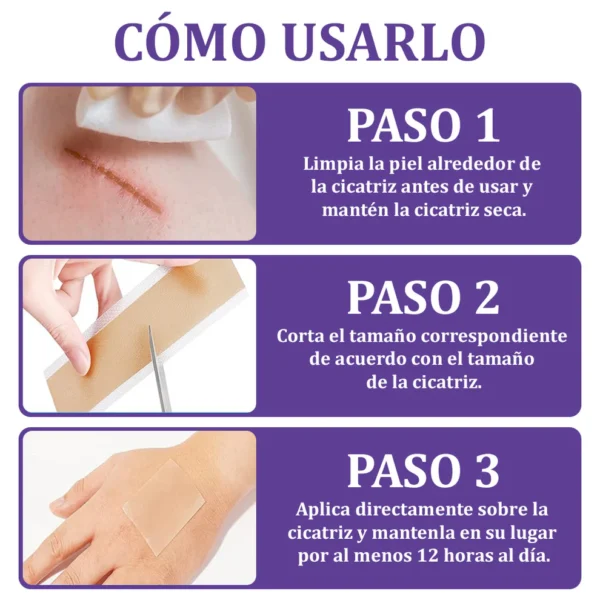 🏷️ Tienda Oficial: Flysmus® ReGen Cinta de Micronadles con Ácido Hialurónico Nano-Heal 💝 Tratamiento de cicatrices nuevas y antiguas, reducción de cicatrices quirúrgicas, estrías, queloides, acné, quemaduras, verrugas, dermatomas y venas varicosas