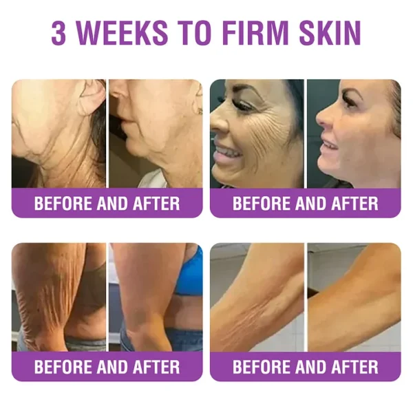 YUNPSO™ Queen Nectar Peptide + Bakuchiol Skin Restoration Cream - Anti-aging, Hydrating, Skin Firming & Lifting, Skin Repair, Even Tone, Acne and Dark Spot Treatment, Wart and Mole Removal, and Psoriasis Relief.