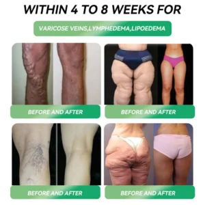 💖Official Store | Honxi® NAD+ GLP-1 Oral Liquid for Weight Loss & Metabolic Health (Just once a day, visible changes in 7 days) ✅ For obesity, cardiovascular health, diabetes, sleep apnea, gut health, joint issues, and more