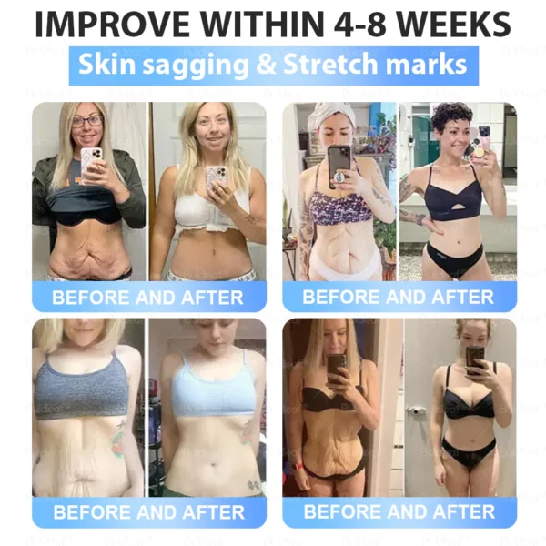 🇨🇦Clinically Proven| Official Store | BuildLeaf® Tirzepatide Slimming & Health Nano Microneedle Patch |Targets Obesity, Loose Skin, High Blood Pressure, Diabetes, Fatty Liver, Joint Pain, Brain Fog, Low Energy, Body Aches, and More