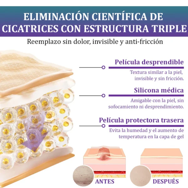 🏷️ Tienda Oficial: Flysmus® ReGen Cinta de Micronadles con Ácido Hialurónico Nano-Heal 💝 Tratamiento de cicatrices nuevas y antiguas, reducción de cicatrices quirúrgicas, estrías, queloides, acné, quemaduras, verrugas, dermatomas y venas varicosas