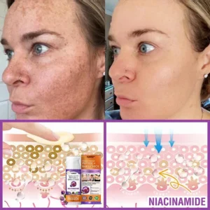 YUNPSO™ Queen Nectar Peptide + Bakuchiol Skin Restoration Cream - Anti-aging, Hydrating, Skin Firming & Lifting, Skin Repair, Even Tone, Acne and Dark Spot Treatment, Wart and Mole Removal, and Psoriasis Relief.