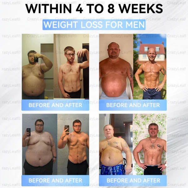 🇨🇦Clinically Proven| Official Store | BuildLeaf® Tirzepatide Slimming & Health Nano Microneedle Patch |Targets Obesity, Loose Skin, High Blood Pressure, Diabetes, Fatty Liver, Joint Pain, Brain Fog, Low Energy, Body Aches, and More