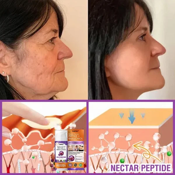 YUNPSO™ Queen Nectar Peptide + Bakuchiol Skin Restoration Cream - Anti-aging, Hydrating, Skin Firming & Lifting, Skin Repair, Even Tone, Acne and Dark Spot Treatment, Wart and Mole Removal, and Psoriasis Relief.