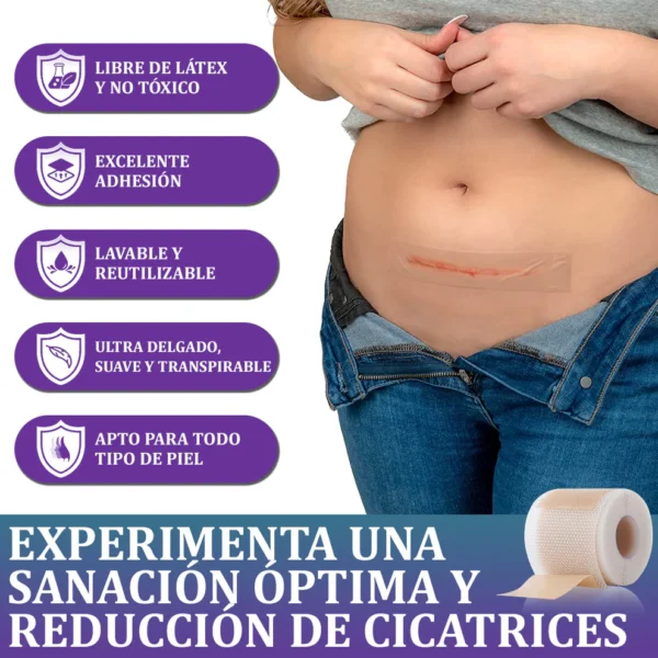🏷️ Tienda Oficial: Flysmus® ReGen Cinta de Micronadles con Ácido Hialurónico Nano-Heal 💝 Tratamiento de cicatrices nuevas y antiguas, reducción de cicatrices quirúrgicas, estrías, queloides, acné, quemaduras, verrugas, dermatomas y venas varicosas