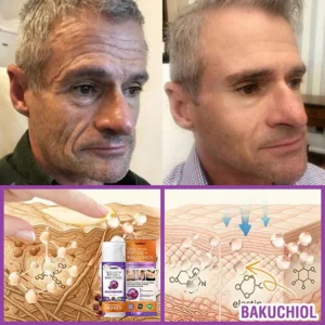 YUNPSO™ Queen Nectar Peptide + Bakuchiol Skin Restoration Cream - Anti-aging, Hydrating, Skin Firming & Lifting, Skin Repair, Even Tone, Acne and Dark Spot Treatment, Wart and Mole Removal, and Psoriasis Relief.