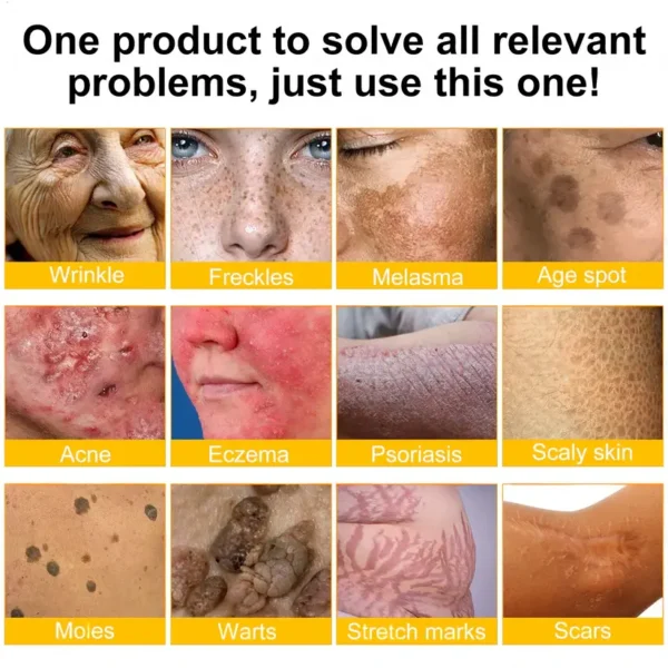 BBOJI® Bee venom Pro Comprehensive Cream