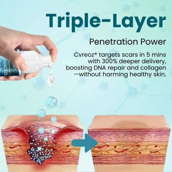 Cvreoz® Advanced Scar Gel