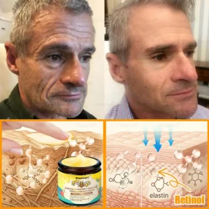 Daasry® Bee Venom Treatment Cream