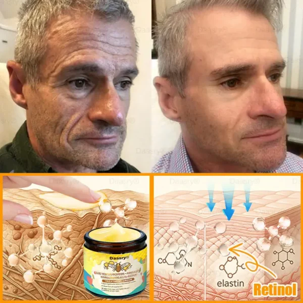 Daasry® Bee Venom Treatment Cream