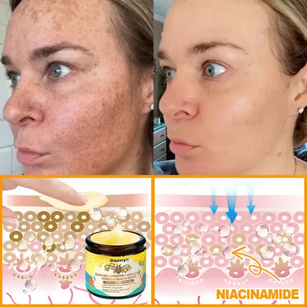 Daasry® Bee Venom Treatment Cream