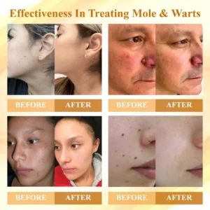 Fivfivgo™ Condense Mellifera Venom Skin Repairing Cream