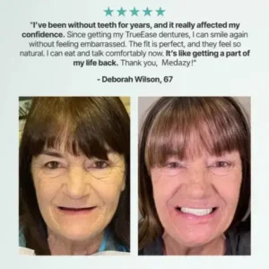 Medazy™ Custom-Fit Full Functional Dentures
