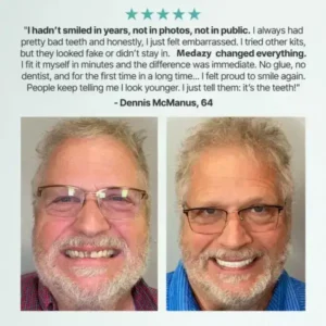 Medazy™ Custom-Fit Full Functional Dentures