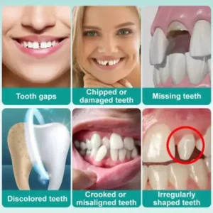 🦷Medazy® Instant Stick-on Dental Veneers (✅Clinically proven, easy-to-use dental veneers trusted by over 8,000 US users for a comfortable, natural smile.)