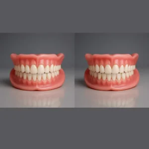NESLEMY™ Custom-Fit Functional Dentures