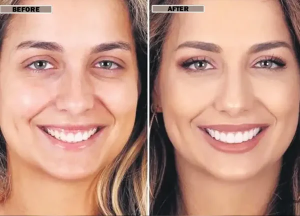 NESLEMY™Coconut Whitening Strips