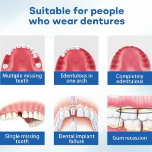 Nurbini® ThermoSeal Fresh Denture - ✅ Clinically proven to completely solve denture slippage and discomfort!